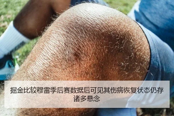 掘金比较穆雷季后赛数据后可见其伤病恢复状态仍存诸多悬念